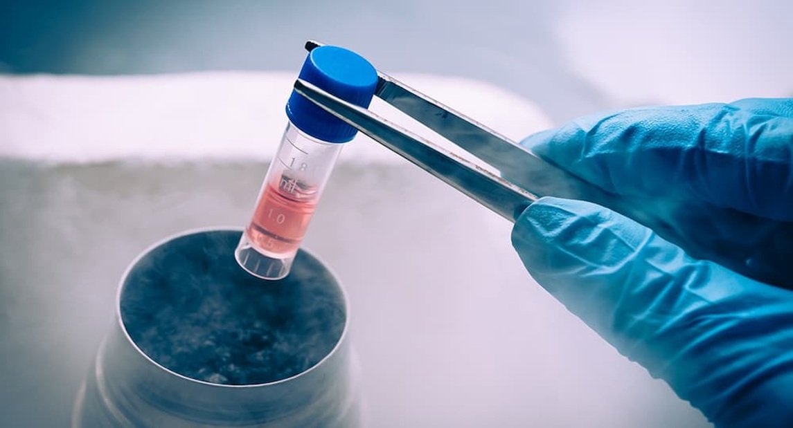 Bioestimulación con Factores de Crecimiento Autólogos