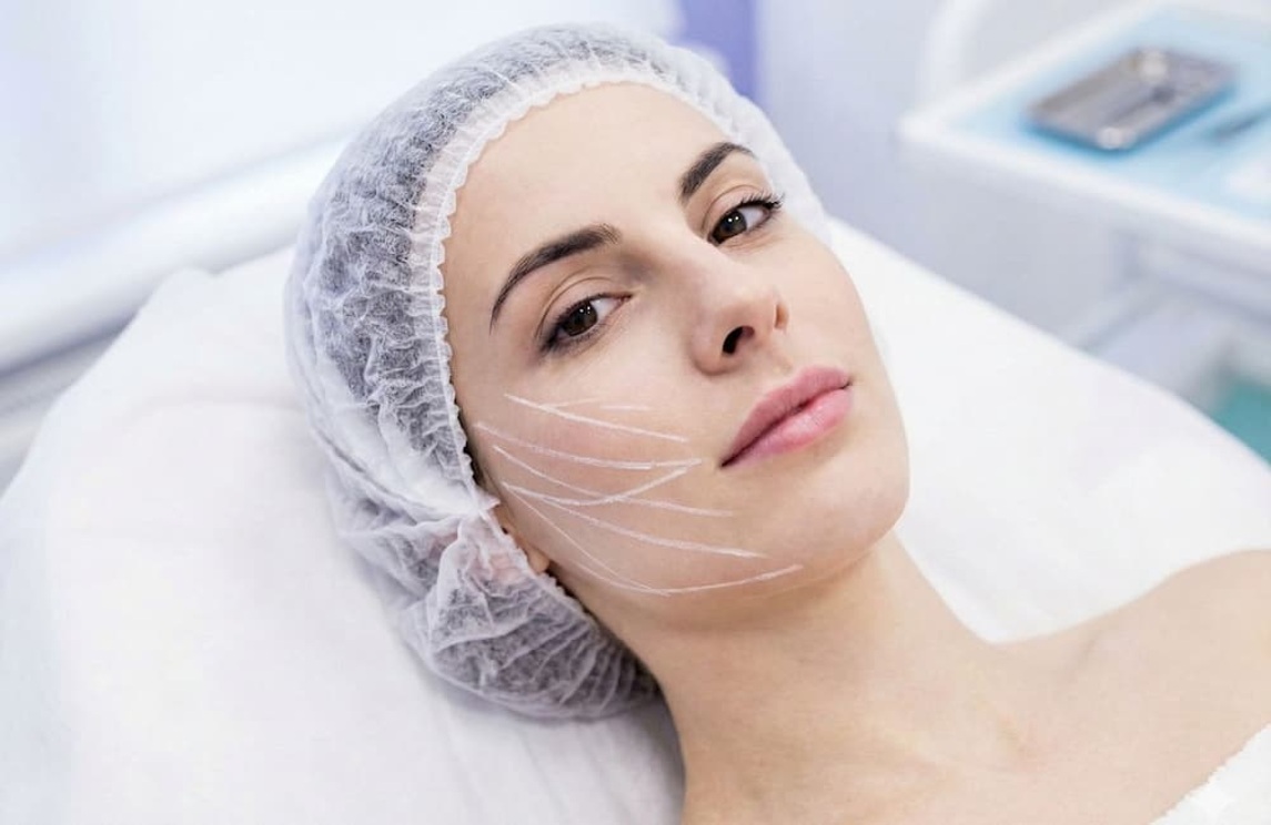 Pérdida de firmeza y óvalo facial