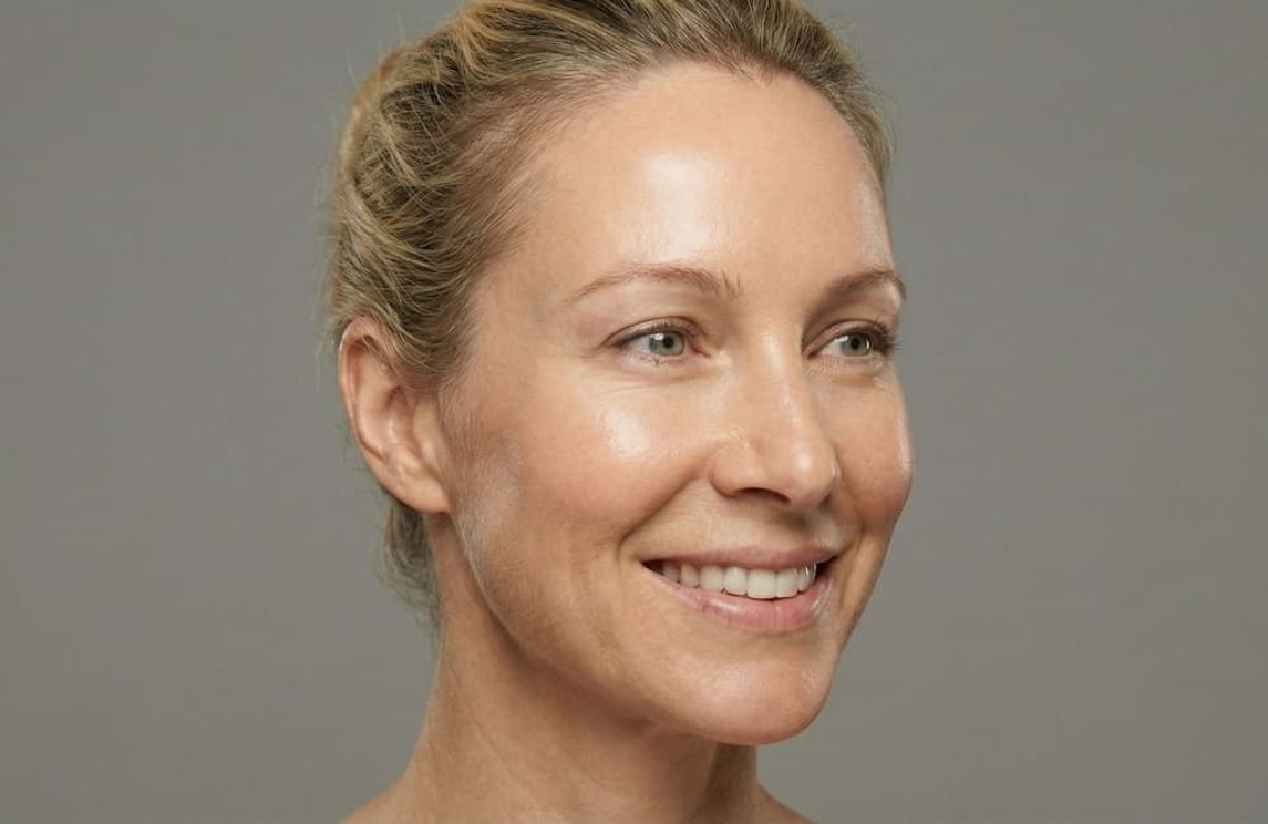 Arrugas de expresión