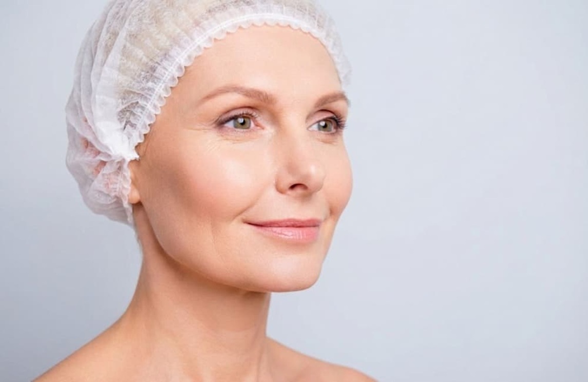 Surcos nasogenianos y líneas de marioneta