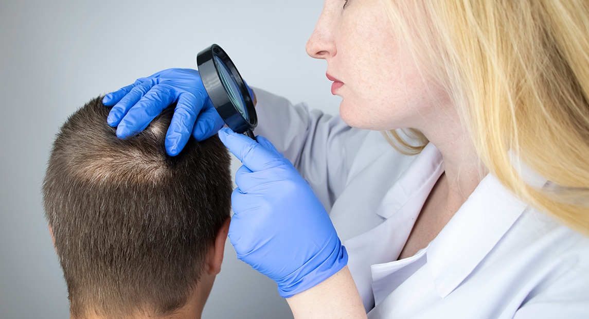 Tratamiento de la alopecia